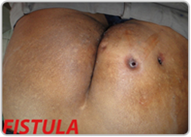 Dr.Kashid Hospital & Piles Clinic